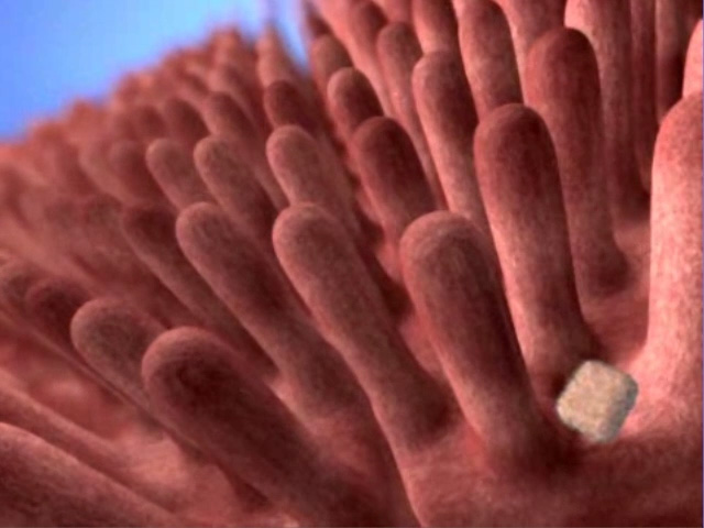 Medical Animation from Visual Health Solutions