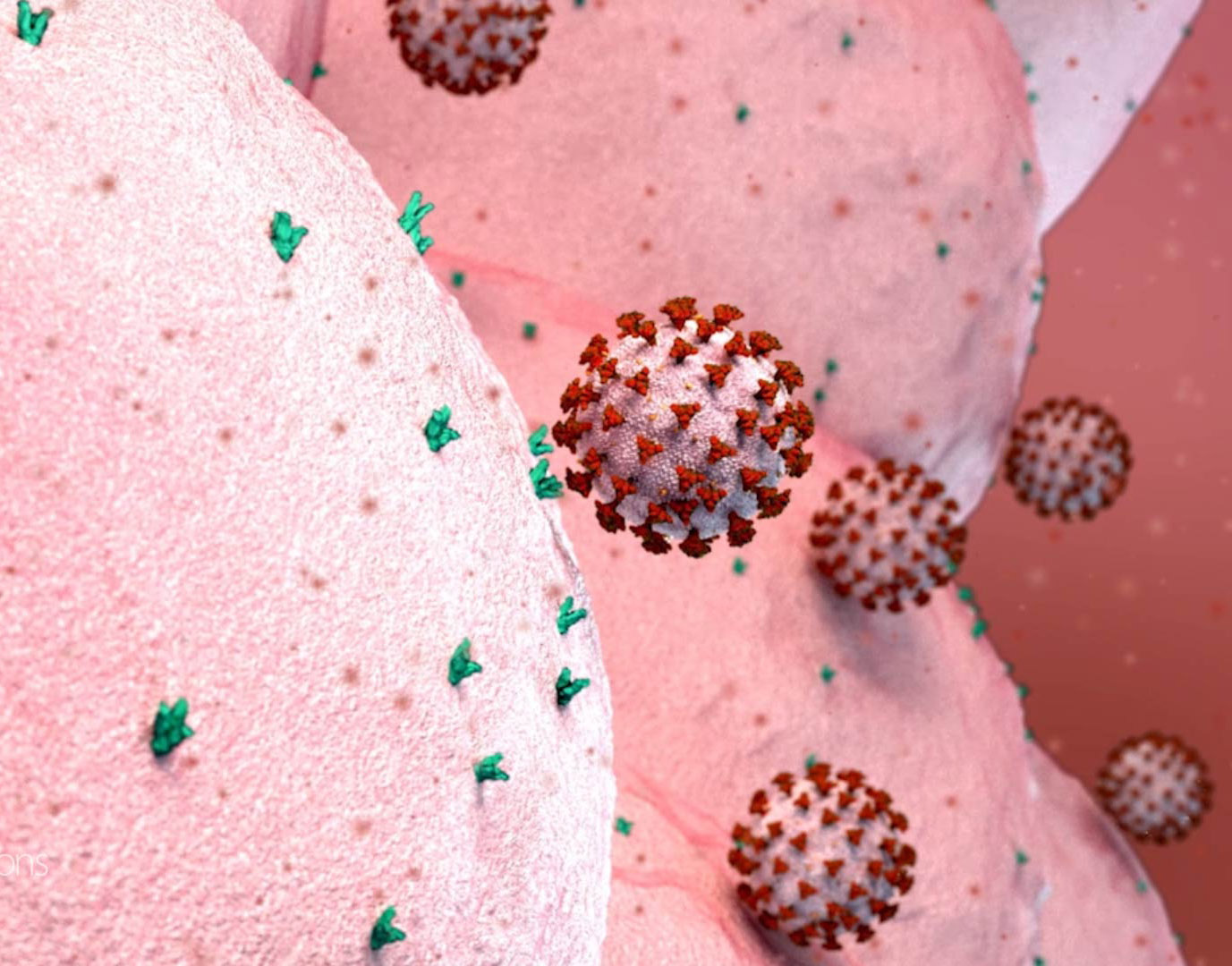 Medical Animation from Visual Health Solutions